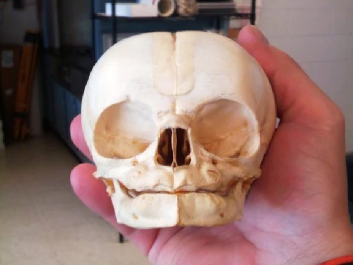 CRANEO DE UNA CRIATURA